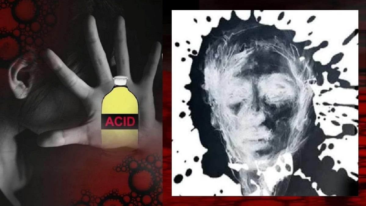 Delhi छात्र ने एसिड अटैक का दावा किया, लेकिन पुलिस ने एक भयानक योजना का पता लगाया 1 Delhi